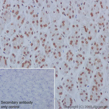 Immunohistochemistry (Formalin/PFA-fixed paraffin-embedded sections) - Anti-YB1 antibody [EP2708Y] - BSA and Azide free (AB239875)
