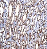 Immunohistochemistry (Formalin/PFA-fixed paraffin-embedded sections) - Anti-YB1 antibody [EP2708Y] - BSA and Azide free (AB239875)