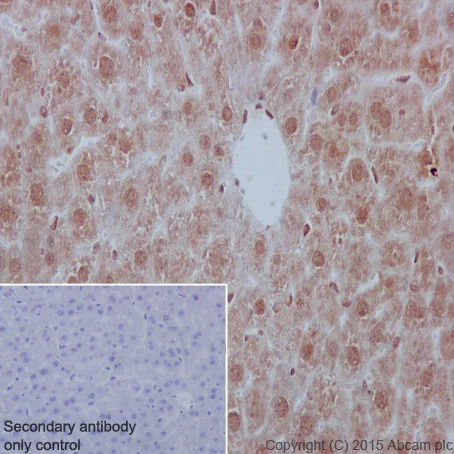 Immunohistochemistry (Formalin/PFA-fixed paraffin-embedded sections) - Anti-YB1 antibody [EP2708Y] - BSA and Azide free (AB239875)