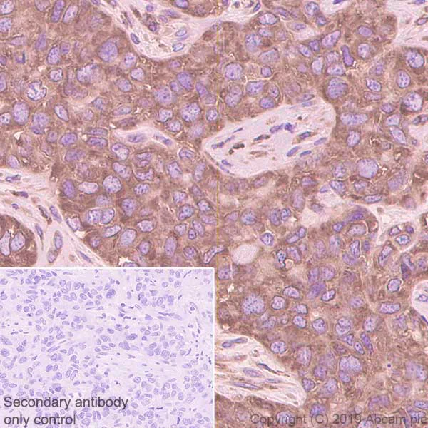 Immunohistochemistry (Formalin/PFA-fixed paraffin-embedded sections) - Anti-YB1 antibody [EPR22682-21] - BSA and Azide free (AB256516)