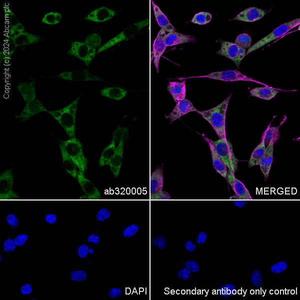 Immunocytochemistry/ Immunofluorescence - Anti-YB1 antibody [RM1188] (AB320005)
