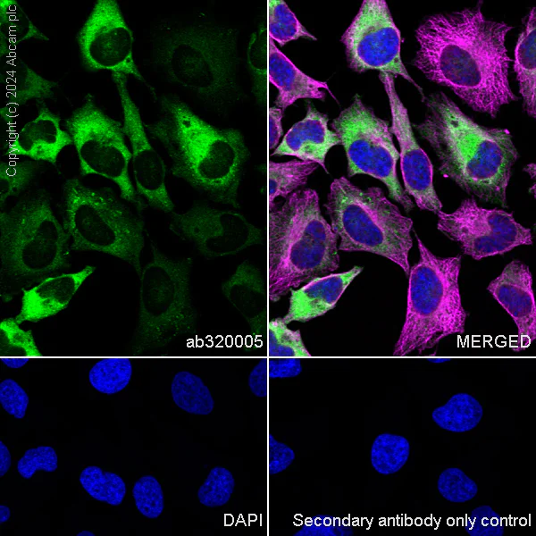 Immunocytochemistry/ Immunofluorescence - Anti-YB1 antibody [RM1188] (AB320005)