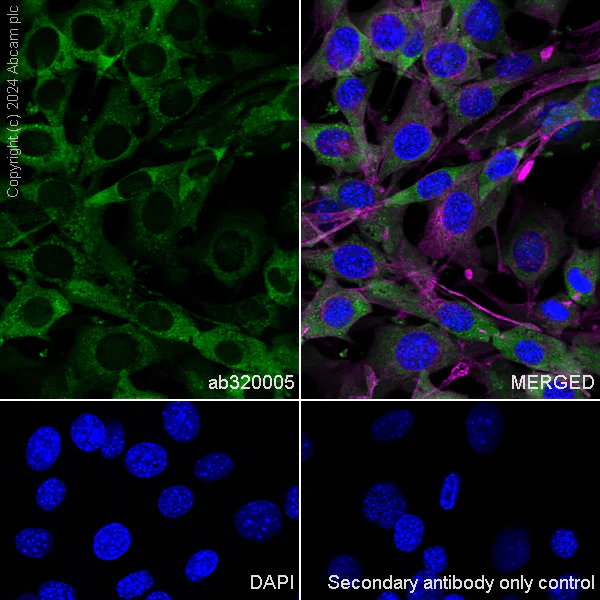 Immunocytochemistry/ Immunofluorescence - Anti-YB1 antibody [RM1188] (AB320005)