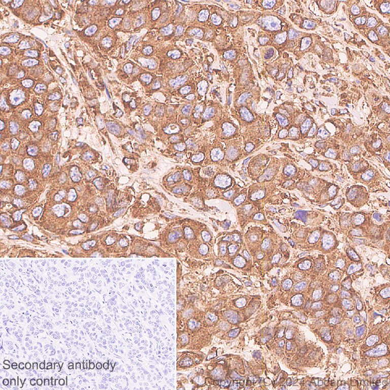Immunohistochemistry (Formalin/PFA-fixed paraffin-embedded sections) - Anti-YB1 antibody [RM1188] (AB320005)