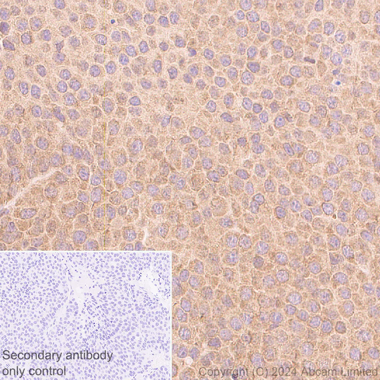Immunohistochemistry (Formalin/PFA-fixed paraffin-embedded sections) - Anti-YB1 antibody [RM1188] (AB320005)