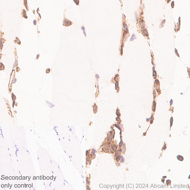 Immunohistochemistry (Formalin/PFA-fixed paraffin-embedded sections) - Anti-YB1 antibody [RM1188] (AB320005)