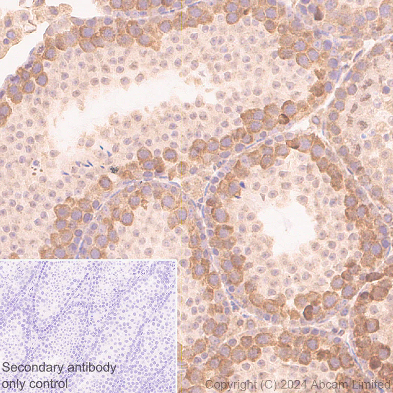 Immunohistochemistry (Formalin/PFA-fixed paraffin-embedded sections) - Anti-YB1 antibody [RM1188] (AB320005)