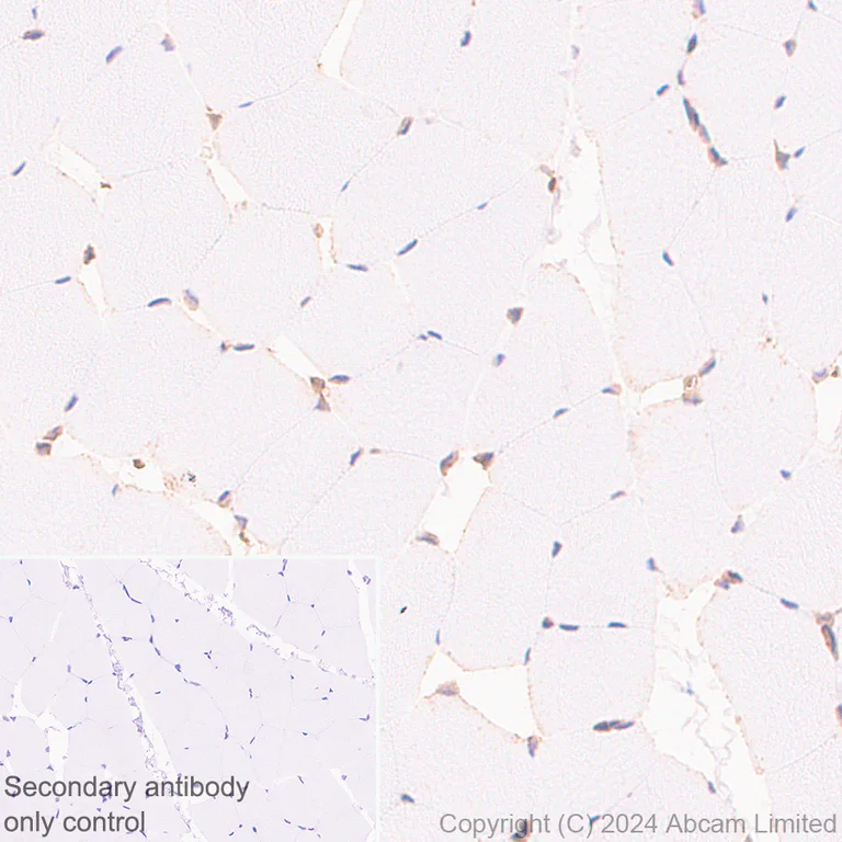 Immunohistochemistry (Formalin/PFA-fixed paraffin-embedded sections) - Anti-YB1 antibody [RM1188] (AB320005)