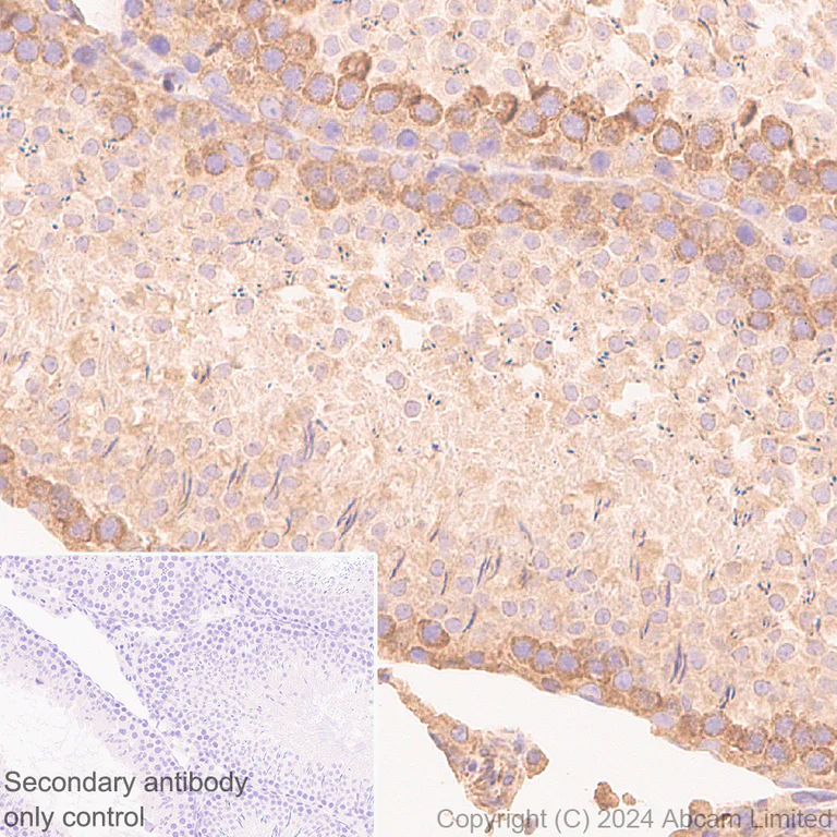 Immunohistochemistry (Formalin/PFA-fixed paraffin-embedded sections) - Anti-YB1 antibody [RM1188] (AB320005)