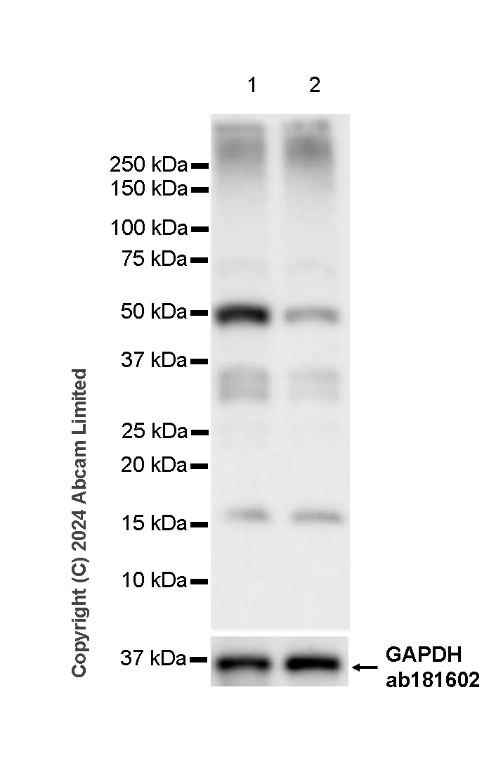 Western blot - Anti-YB1 antibody [RM1188] (AB320005)