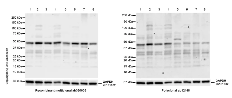Western blot - Anti-YB1 antibody [RM1188] (AB320005)