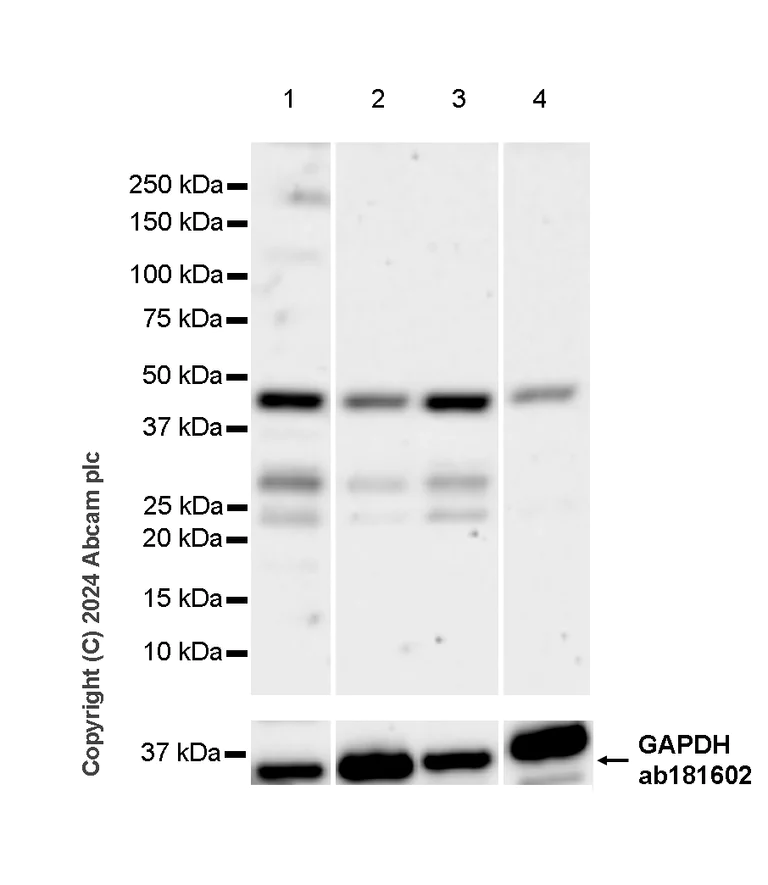 Western blot - Anti-YB1 antibody [RM1188] (AB320005)
