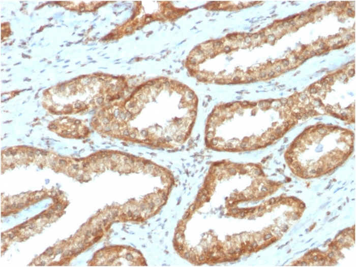 Immunohistochemistry (Formalin/PFA-fixed paraffin-embedded sections) - Anti-YB1 antibody [YBX1/2430] (AB268094)