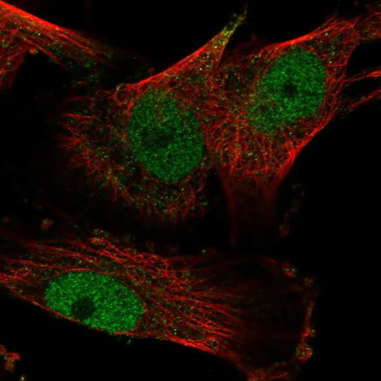 Immunocytochemistry/ Immunofluorescence - Anti-YEATS2 antibody (AB254895)