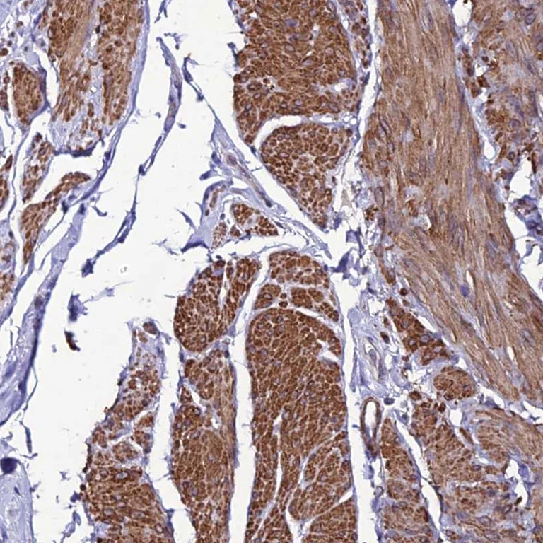 Immunohistochemistry (Formalin/PFA-fixed paraffin-embedded sections) - Anti-YEATS2 antibody (AB254895)