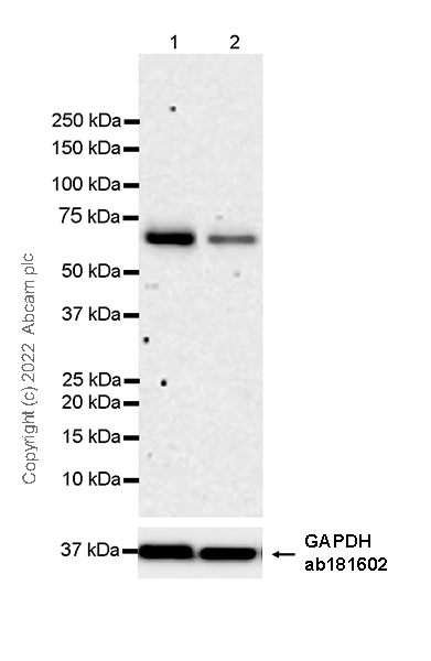 Western blot - Anti-Yes antibody [1/Yes] (AB305327), expandable thumbnail