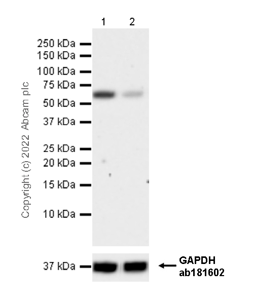 Western blot - Anti-Yes antibody [1/Yes] (AB305327), expandable thumbnail