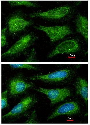 Immunocytochemistry/ Immunofluorescence - Anti-Yes1 antibody (AB152108), expandable thumbnail