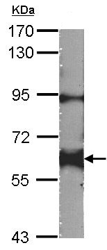 Western blot - Anti-Yes1 antibody (AB152108), expandable thumbnail