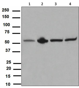 Western blot - Anti-Yes1 antibody [EPR3172] - BSA and Azide free (AB248467), expandable thumbnail