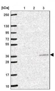 Western blot - Anti-YIF1B antibody (AB188127)