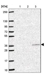 Western blot - Anti-YIF1B antibody (AB188127)