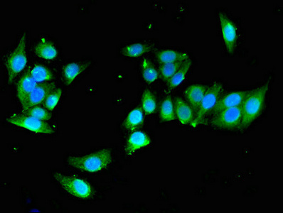 Immunocytochemistry/ Immunofluorescence - Anti-YIPF3 antibody (AB223505)