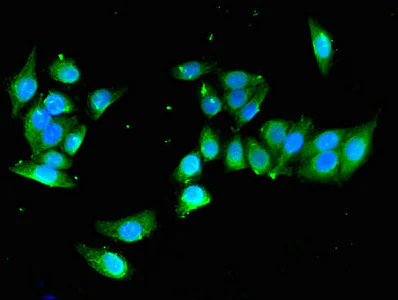 Immunocytochemistry/ Immunofluorescence - Anti-YIPF3 antibody (AB223505)