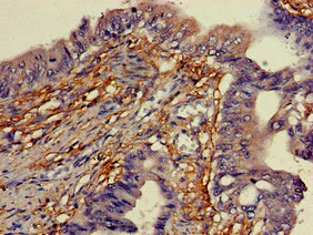 Immunohistochemistry (Formalin/PFA-fixed paraffin-embedded sections) - Anti-YIPF3 antibody (AB223505)
