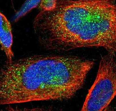 Immunocytochemistry/ Immunofluorescence - Anti-YIPF6 antibody (AB224224)