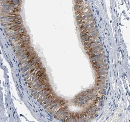 Immunohistochemistry (Formalin/PFA-fixed paraffin-embedded sections) - Anti-YIPF6 antibody (AB224224)