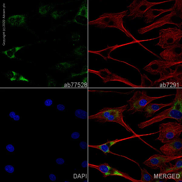 Immunocytochemistry/ Immunofluorescence - Anti-YKL-40/CHI3L1 antibody (AB77528)
