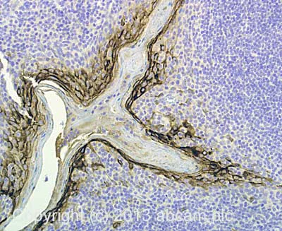 Immunohistochemistry (Formalin/PFA-fixed paraffin-embedded sections) - Anti-YKL-40/CHI3L1 antibody (AB77528)