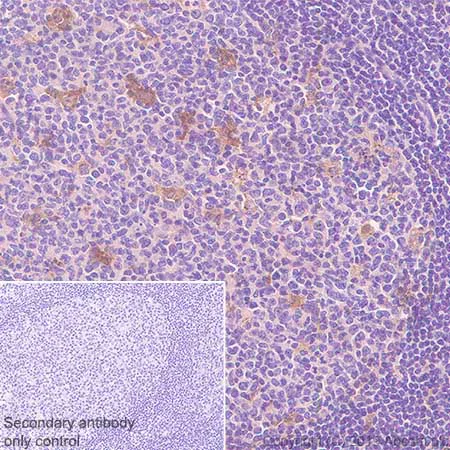 Immunohistochemistry (Formalin/PFA-fixed paraffin-embedded sections) - Anti-YKL-40/CHI3L1 antibody [EPR19078-157] - BSA and Azide free (AB255864)