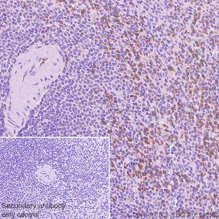 Immunohistochemistry (Formalin/PFA-fixed paraffin-embedded sections) - Anti-YKL-40/CHI3L1 antibody [EPR19078-157] - BSA and Azide free (AB255864)