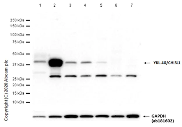 Western blot - Anti-YKL-40/CHI3L1 antibody [EPR19078-157] - BSA and Azide free (AB255864)