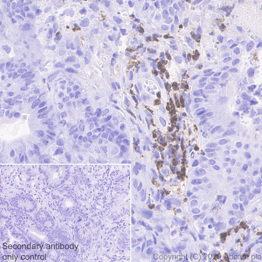 Immunohistochemistry (Formalin/PFA-fixed paraffin-embedded sections) - Anti-YKL-40/CHI3L1 antibody [EPR23891-162] - BSA and Azide free (AB278105), expandable thumbnail