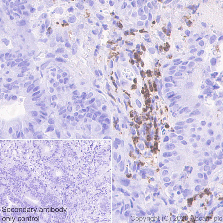 Immunohistochemistry (Formalin/PFA-fixed paraffin-embedded sections) - Anti-YKL-40/CHI3L1 antibody [EPR23891-162] - BSA and Azide free (AB278105)