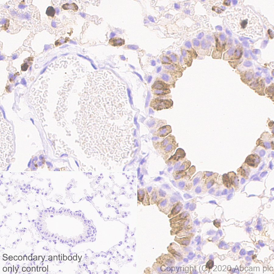 Immunohistochemistry (Formalin/PFA-fixed paraffin-embedded sections) - Anti-YKL-40/CHI3L1 antibody [EPR23891-162] - BSA and Azide free (AB278105), expandable thumbnail