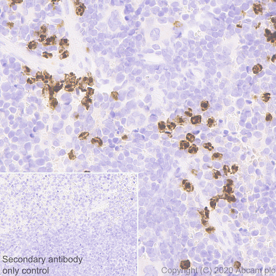 Immunohistochemistry (Formalin/PFA-fixed paraffin-embedded sections) - Anti-YKL-40/CHI3L1 antibody [EPR23891-162] - BSA and Azide free (AB278105), expandable thumbnail