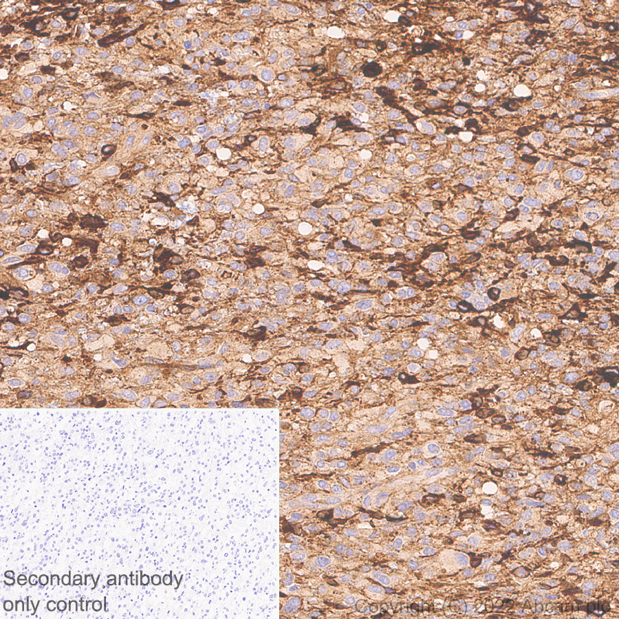Immunohistochemistry - Anti-YKL-40/CHI3L1 antibody [EPR27396-56] (ab305035), expandable thumbnail