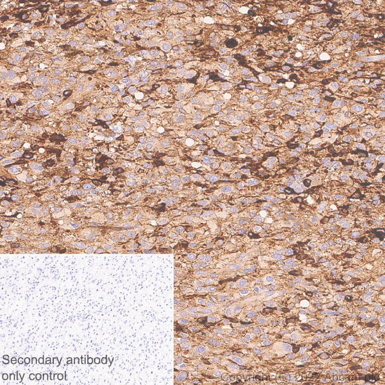 Immunohistochemistry - Anti-YKL-40/CHI3L1 antibody [EPR27396-56] - BSA and Azide free (AB305036)