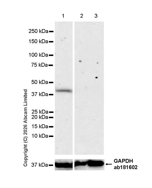 Western blot - Anti-YKL-40/CHI3L1 antibody [EPR29069-14] - BSA and Azide free, low endotoxin (AB326958)