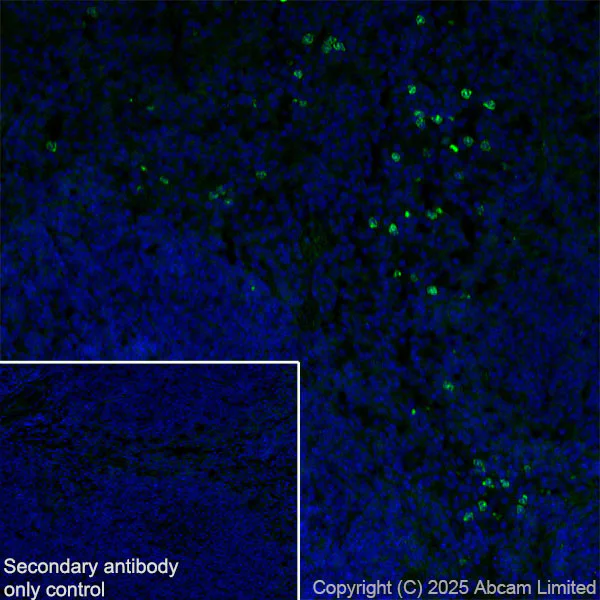 Immunohistochemistry (Frozen sections) - Anti-YKL-40/CHI3L1 antibody [EPR29069-26] (AB324383)