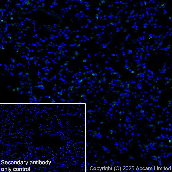 Immunohistochemistry (Frozen sections) - Anti-YKL-40/CHI3L1 antibody [EPR29069-26] (AB324383)
