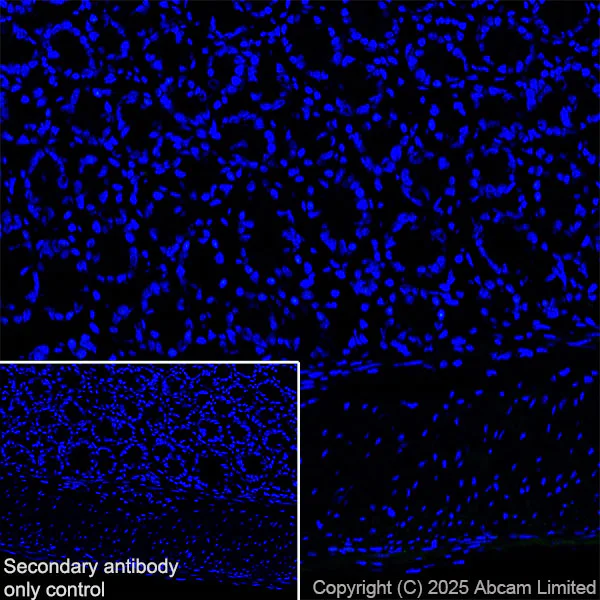 Immunohistochemistry (Frozen sections) - Anti-YKL-40/CHI3L1 antibody [EPR29069-26] (AB324383)
