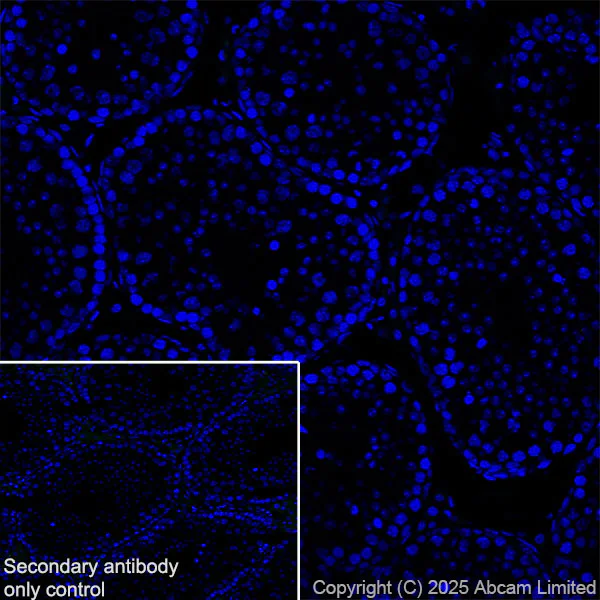 Immunohistochemistry (Frozen sections) - Anti-YKL-40/CHI3L1 antibody [EPR29069-26] (AB324383)