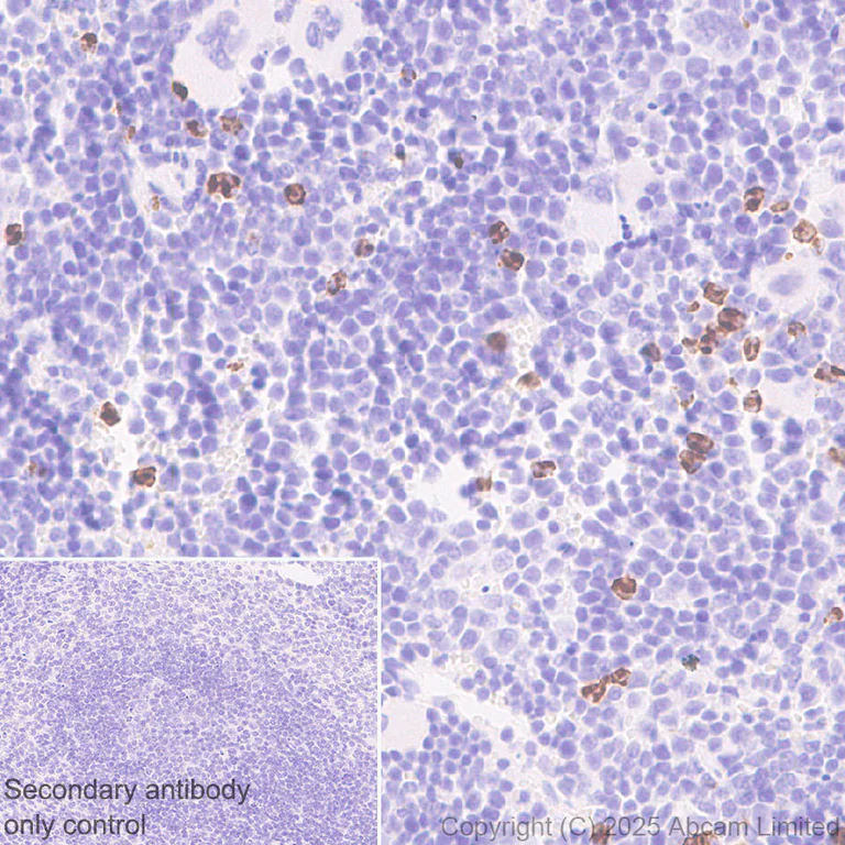Immunohistochemistry (Formalin/PFA-fixed paraffin-embedded sections) - Anti-YKL-40/CHI3L1 antibody [EPR29069-26] - BSA and Azide free (AB324461)