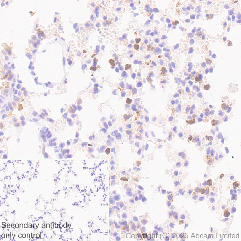 Immunohistochemistry (Formalin/PFA-fixed paraffin-embedded sections) - Anti-YKL-40/CHI3L1 antibody [EPR29069-26] - BSA and Azide free (AB324461)