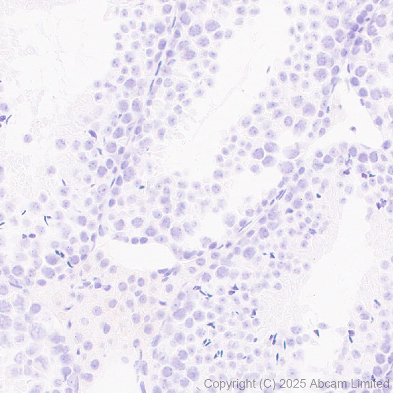 Immunohistochemistry (Formalin/PFA-fixed paraffin-embedded sections) - Anti-YKL-40/CHI3L1 antibody [EPR29069-26] - BSA and Azide free (AB324461)